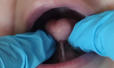 Caso Clínico: Helena, 2 anos